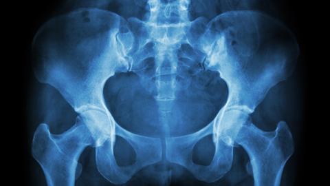 Roentgenbild eines menschlichen Beckens